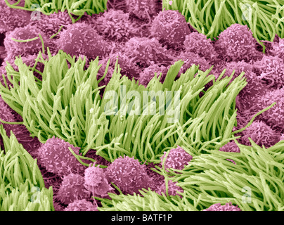 Les trompes de Fallope. Couleur de l'analyse des electronmicrograph (SEM) de la surface d'un fallopiantube, montrant les cellules vert et rose Banque D'Images