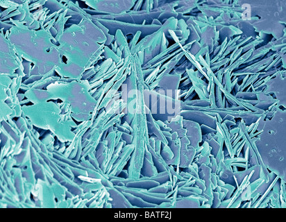 Calculs biliaires. Couleur de l'analyse des électrons Microphotographie (SEM) d'une fracture de la lithiase biliaire. Les calculs biliaires se forment dans la vésicule Banque D'Images