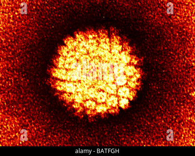 Le virus du papillome humain (VPH), colorés transmissionelectron microphotographie (TEM). Banque D'Images