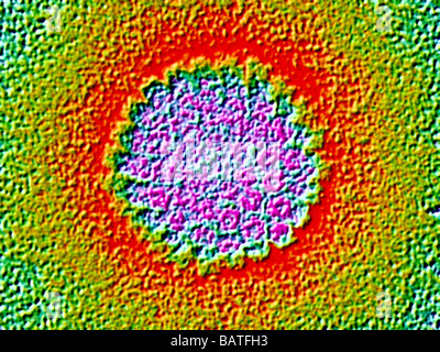Le virus du papillome humain (VPH), colorés transmissionelectron microphotographie (TEM). Banque D'Images