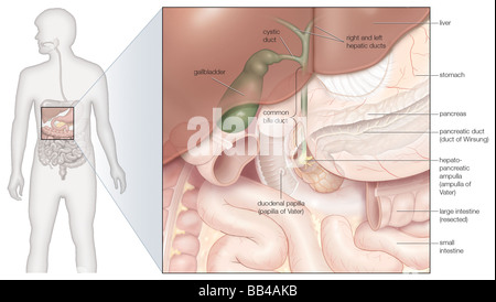 La vésicule et voies biliaires dans situ Banque D'Images