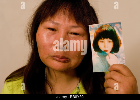 Wang Ying, 22 ans, est titulaire d'une photographie d'elle-même âgée de 17 ans, avant qu'elle ait la chirurgie plastique avec Ao Mei Ding que défiguré son visage. Banque D'Images