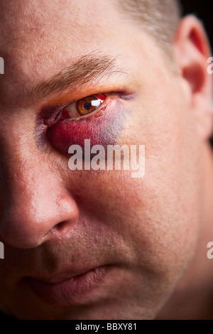 Close up of man avec l'accent sur l'œil noir eye Banque D'Images