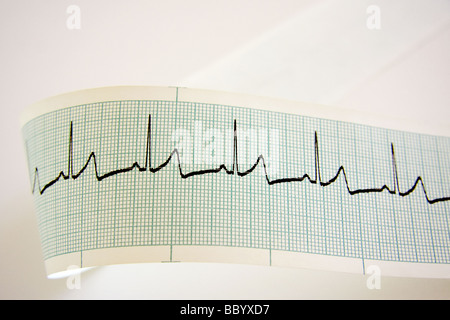 Le contrôle de la fréquence cardiaque Banque D'Images