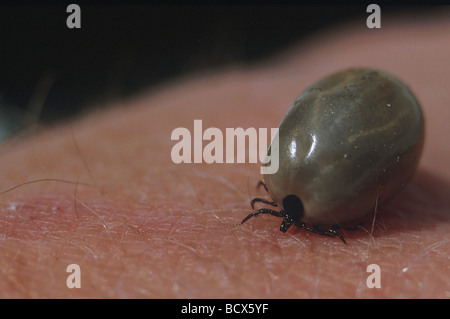 Ricin tique (Ixodes ricinus), femme complètement gonflés avec du sang sur la peau humaine Banque D'Images