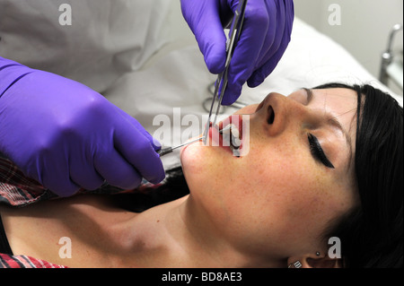 Une femme a sa lèvre inférieure percée d'un goujon Banque D'Images