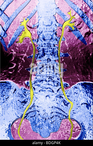 Système urinaire, X-RAY TROUVER Banque D'Images