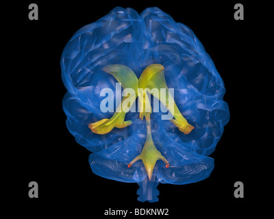 Modèle graphique de l'ordinateur du cerveau humain avec l'emplacement de l'du liquide céphalo-rachidien dans le cerveau du système ventriculaire Banque D'Images