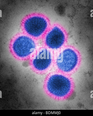 Images de la nouveau virus grippal H1N1 Banque D'Images