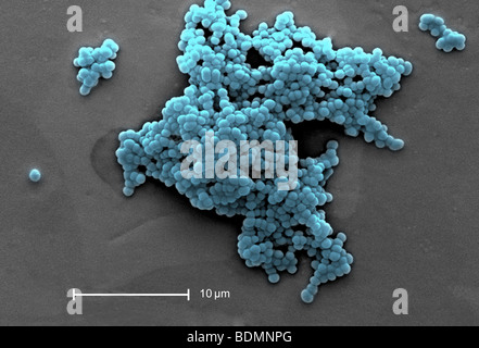 L'analyse des électrons Microphotographie (SEM) de grappes de bactéries Gram-positives, bêta-hémolytique du groupe C bactéries Streptococcus sp. Banque D'Images