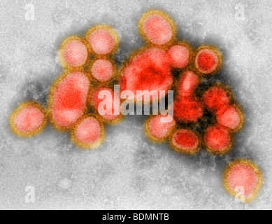 Images de la nouveau virus grippal H1N1 Banque D'Images