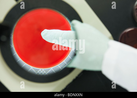 L'analyse scientifique de la plaque artérielle Banque D'Images