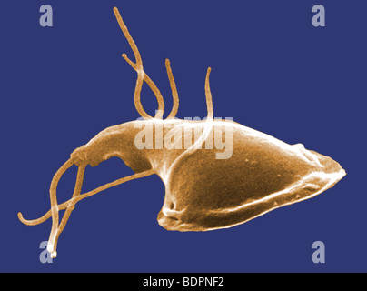 Cette colorisée numériquement l'analyse des électrons Microphotographie (SEM) dépeint la face dorsale (supérieure) de surface d'un protozoaire Giardia Banque D'Images