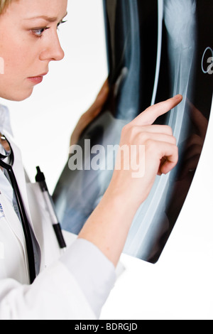 Une femme médecin tenant une plaque de rayons X Banque D'Images