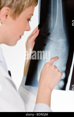 Une femme médecin tenant une plaque de rayons X Banque D'Images