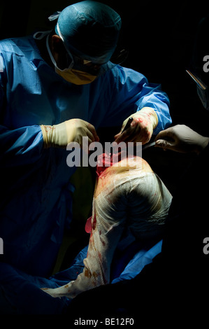 Un patient subit une chirurgie de remplacement du genou dans un hôpital de West Midlands, après un diagnostic de dommages irréparables Banque D'Images