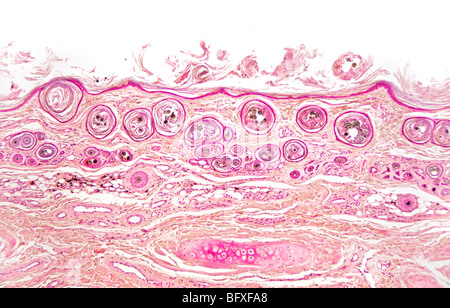 Follicule de cheveux de mammifères détail dans peau extérieure, fond clair photomicrographie Banque D'Images