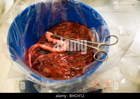 Le placenta, une demi-heure après la naissance. Banque D'Images