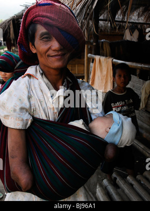 Les personnes handicapées sans les mains de réfugiés karens carrying baby,umpium(thai camp de réfugiés à la frontière birmane) , au sud de Mae Sot , tak,Thailand Banque D'Images