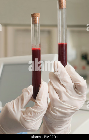 Lab technician holding des échantillons de sang dans un tube à essai Banque D'Images