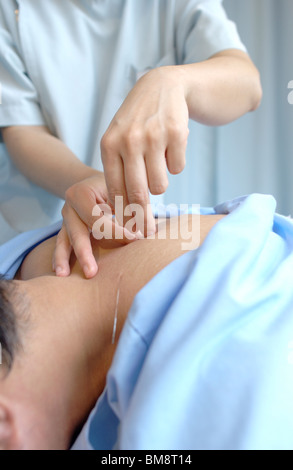 Jeune femme de mettre les aiguilles d'acupuncture sur l'homme est de retour, Close up Banque D'Images