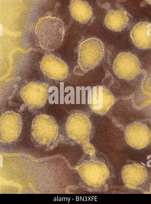 Teinté négativement micrographie électronique à transmission (TEM) de La Crosse (BAC) virus de l'encéphalite de particules ribonucléoprotéiques Banque D'Images