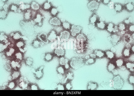 Teinté négativement micrographie électronique à transmission (TEM) de La Crosse (BAC) virus de l'encéphalite de particules ribonucléoprotéiques Banque D'Images