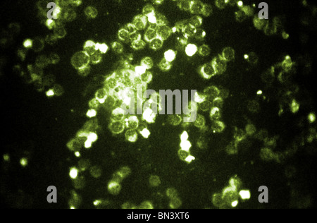 Photomicrographie montrant le virus respiratoire syncytial (VRS) à l'aide technique d'immunofluorescence indirecte Banque D'Images