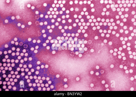 Micrographie électronique à transmission (TEM) de poliovirus sauvage de type 1 vu avec coloration négative Banque D'Images