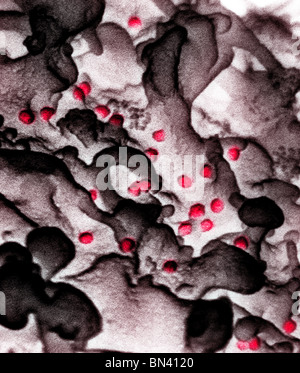 L'analyse des électrons Microphotographie colorisée du virus de l'immunodéficience humaine (VIH), cultivés dans les lymphocytes Banque D'Images
