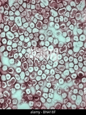 Teinté négativement micrographie électronique à transmission (TEM) de La Crosse (BAC) virus de l'encéphalite de particules ribonucléoprotéiques Banque D'Images