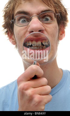 Un jeune adulte est titulaire d'une loupe jusqu'à ses dents de travers à bretelles sur. Banque D'Images