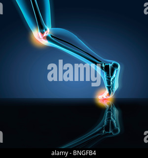 X-ray avis d'un homme montrant la jambe dans la douleur genou, cheville et pied en position de course Banque D'Images