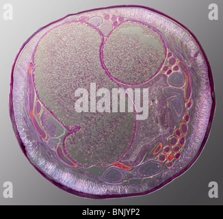 Microphotographie d'une section d'Acaris sp. ver nématode parasitaire (femelle) Banque D'Images