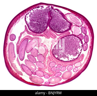 Microphotographie d'une section d'Acaris sp. ver nématode parasitaire (femelle) Banque D'Images