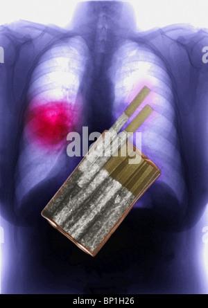 Illustration d'une radiographie d'un paquet de cigarettes en surimpression sur une radiographie montrant le cancer du poumon Banque D'Images