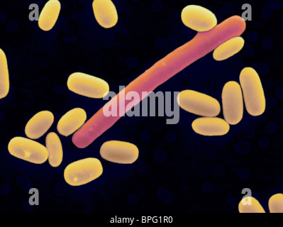 SEM de Clostridium difficile (grande cellule en rouge) entouré par les spores de Clostridium difficile purifiée (jaune) Banque D'Images