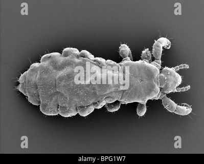 SEM - ou Pediculus humanus - petit insecte suceur avec l'abdomen et les jambes, avec de grandes griffes acérées pour la tenue de cheveux et fibres Banque D'Images