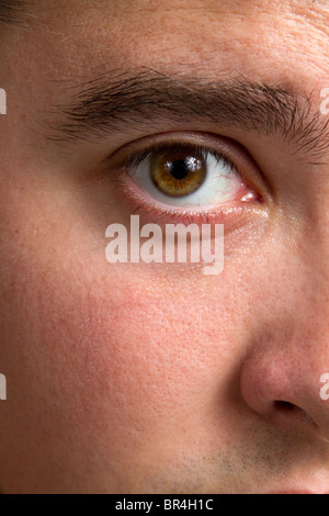 Close up of man's des yeux injectés de sang. Banque D'Images