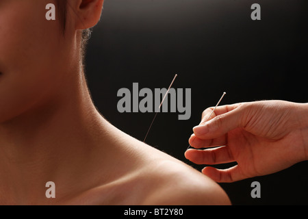 Médecin de mettre les aiguilles d'acupuncture sur le cou de la femme , close-up Banque D'Images