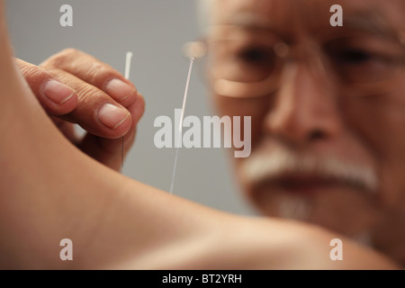 Médecin de mettre les aiguilles d'acupuncture sur le cou de la femme , close-up Banque D'Images