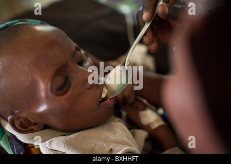 Un enfant meurt du SIDA est spoon-fed dans un hôpital de Amuria, Ouganda, Afrique de l'Est. Banque D'Images