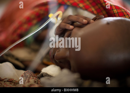 Un enfant meurt du SIDA reçoit un traitement médical dans un hôpital d'Amuria, Ouganda, Afrique de l'Est. Banque D'Images