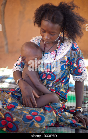 Dans la ville de Djibo, au nord du Burkina Faso, un enfant Peul est malade avec le paludisme, une maladie transmise par les moustiques. Banque D'Images