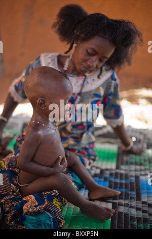 Dans la ville de Djibo, au nord du Burkina Faso, un enfant Peul est malade avec le paludisme, une maladie transmise par les moustiques. Banque D'Images