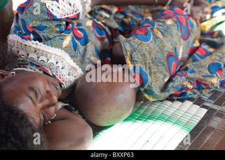 Dans la ville de Djibo, au nord du Burkina Faso, un enfant Peul est malade avec le paludisme. Banque D'Images