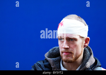 Les blessures à la tête avec de faux manifestants à l'extérieur de New Scotland Yard après qu'un manifestant a été touché et exigé une chirurgie du cerveau. Banque D'Images