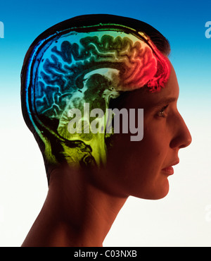 Super-scan cérébral imposé à tête de femme Banque D'Images