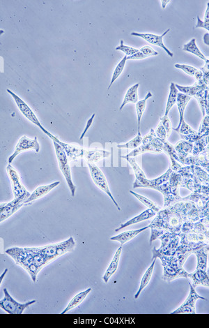 Vue au microscope des cellules du cancer de la prostate dans la culture de tissus montrant les murs, noyau et d'organites. Banque D'Images