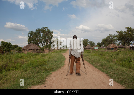 Un homme handicapé promenades à travers un village de Amuria, Ouganda, Afrique de l'Est. Banque D'Images